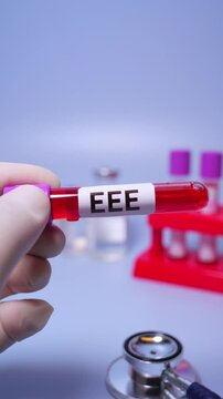 Eastern Equine Encephalitis (EEE) is an extremely rare but serious and often fatal infection that causes encephalitis or inflammation of the brain