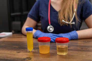 Laborantka przeprowadza badania składu moczu, kontrola antydopingowa. 