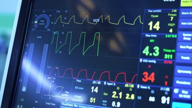 Monitor display with life parameters of a person undergoing surgery. Close up. Equipment of modern surgery room.
