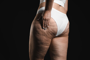 Naklejka premium Woman with cellulite on black background, closeup