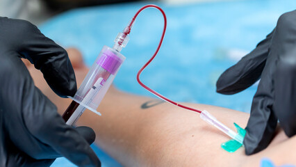 collecting blood samples through the venous system by venipuncture using sterile equipment and EDTA...