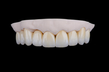 Quality dental crowns of upper jaw made of zirconium stylized as an old teeth on 3D printed model. © gorynvd