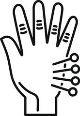 Line drawing of a hand with acupuncture needles being applied by an acupuncturist
