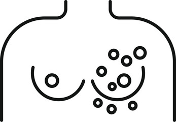 Line drawing representing a woman's chest showing symptoms of breast cancer