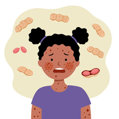 Sad black girl child with peanut allergy symptom in flat design.