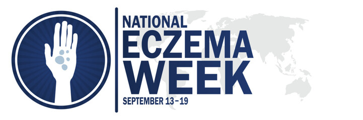 National Eczema Week. September 13 - 19.  Suitable for greeting card, poster and banner. Vector illustration.
