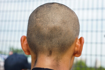 高校野球部員の坊主頭