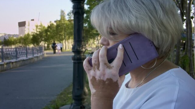 Old blonde woman with pigmentation on hands skin talks by phone on street. Mature lady with vitiligo calls by cellphone in urban park at sunset