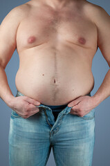 Naklejka premium Obesity concept, close up of overweight man trying to wear too small jeans on grey studio background. Fat guy wearing pair of blue jeans, unbuttoned and slightly pulled down, see pair of underwear