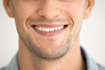 Obraz premium Close up of male toothy smile, shaved chin with stubble, lower face of young model guy. Dental care patient smiling, opening white healthy teeth, promoting stomatology service, dentistry, whitening