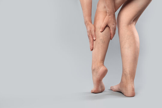 Woman suffering from varicose veins on grey background, closeup. Space for text