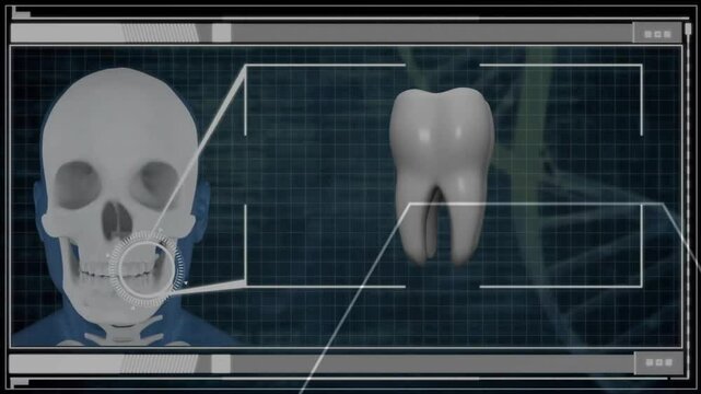 Human skull and tooth examination animation over scientific grid background