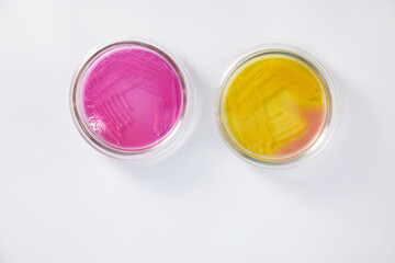 Microbiology Laboratory. Petri Dishes with Various Bacteria Samples