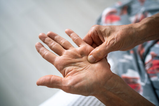 Dupuytren contracture and protuberance on palm. Elderly woman rubs, feels tender hand with stiff knot under ring finger. Senior female has trouble bending finger. Hand tendon malady, stiff knot.