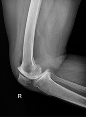 High-Definition X-ray Imaging: Detailed Radiographic Evaluation for Accurate Clinical Diagnosis