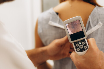 Doctor and female client in dermatology clinic. Macro photo of dermatologist is using dermatoscope for facial skin examination.