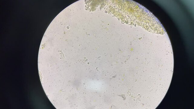 Trichomonas moving.