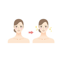 Obraz premium 美容のイラスト しわに悩む女性のビフォーアフター