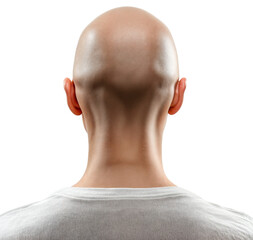 Naklejka premium Back View of a Bald Human Head Isolated on Transparent Background - Ideal for Hair Loss, Scalp Treatment, and Medical Concept Designs