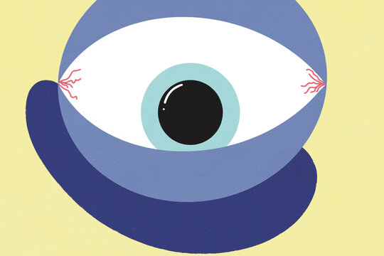 Illustration of eye with red veins and blue sclera over yellow background
