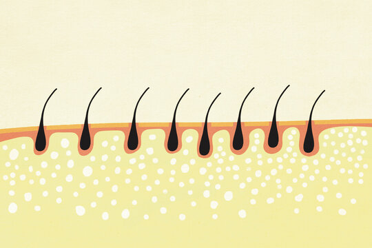 Illustration of hair follicles growing from skin