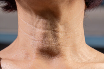 Neck  wrinkles and lines of senior woman. Facial and Neck Skin Aging Change on senior woman.