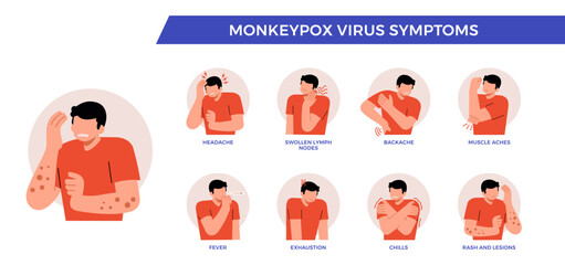 Fototapeta premium Symptoms of monkeypox virus. Monkeypox Mpox disease with maculopapular rash symptom. Information poster. Infographic with character and icon people