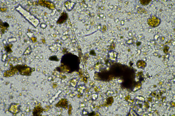 Soil under the microscopy, looking at sand, silt and clay and soil biology, amoebae, fungi, fungal, microbes and nematodes in a cattle farm in australia. 
