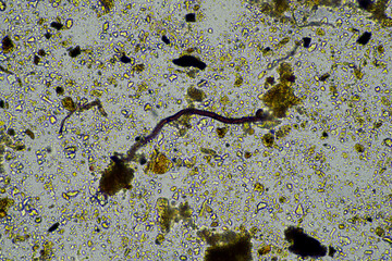 Soil under the microscopy, looking at sand, silt and clay and soil biology, amoebae, fungi, fungal, microbes and nematodes in a cattle farm in australia. 
