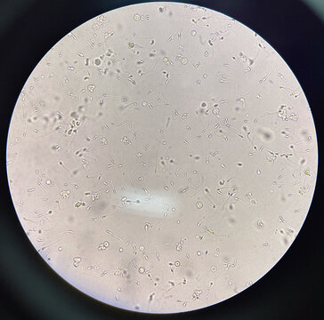 Sperm finding with light microscope 400x