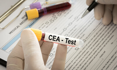 CEA Test concept. doctor holding blood sample tube to Carcinoembryonic Antigen blood test To diagnose cancer, especially colon cancer. © utah51