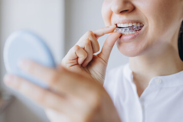 Young Woman Is Putting On Her Invisible Removable Braces Aligner While Looking In The Mirror. Dental Health Medical Care Concept.