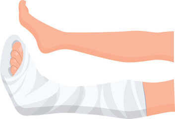 Broken leg Ankle and foot Bandages on the legs