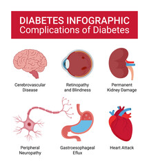Medical Infographics of Diabetes Disease Complications