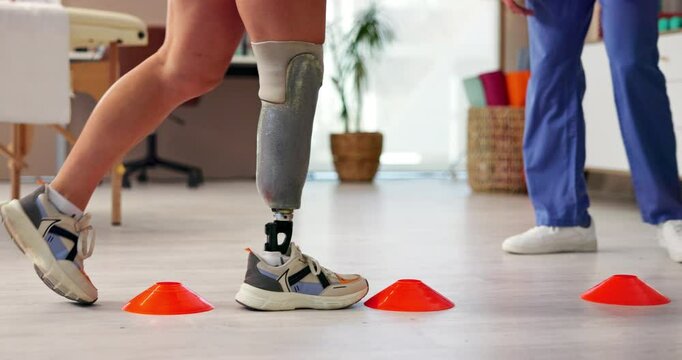 Legs, prosthetic or walking with patient and physiotherapist in office for recovery or rehabilitation. Help, improvement or steps with amputee person and medicine professional in therapy clinic