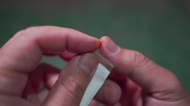 the wound on the finger is treated with iodine solution on a cotton swa