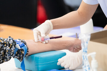 Blood sample from a vein, Nurse taking Real Blood samples analysis from a vein of the patient,...