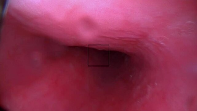 Gastroscopy examination of the gullet and stomach