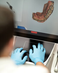 dentist performs 3D scan of oral cavity. Dentist working with intraoral scanner. 3D model of patient's jaw on monitor. Creation of digital impressions of teeth by dentist. Computer 3D modeling.