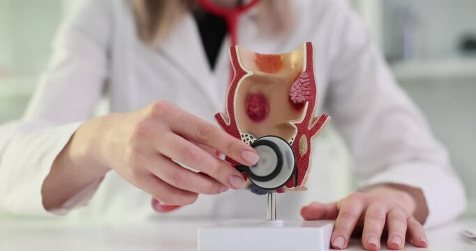 Proctologist uses a stethoscope to listen to artificial model of rectum of person with hemorrhoids