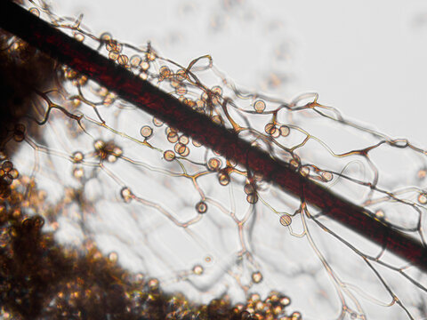 Spores, sporangia, mycelium, hypha of Stemonitis Splendens slime mold grown on rotting wood. Seen in optical microscope with 40x objective