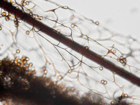 Spores, sporangia, mycelium, hypha of Stemonitis Splendens slime mold grown on rotting wood. Seen in optical microscope with 40x objective