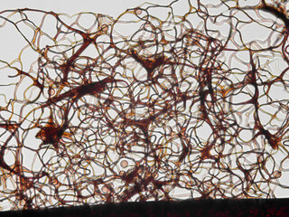 Spores, sporangia, mycelium, hypha of Stemonitis Splendens slime mold grown on rotting wood. Seen in optical microscope with 40x objective