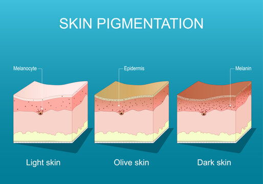 Skin pigmentation. Human skin color ranges