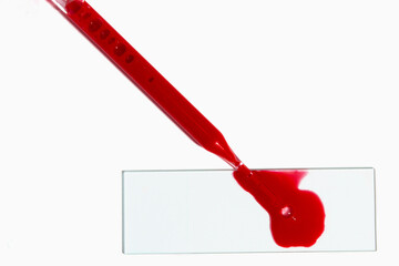 A pipette with blood and a laboratory glass with a drop of blood