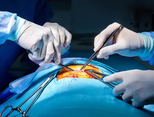 The hands of some surgeons in a surgical operation