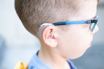 hearing aids in the ears of a 10-year-old boy on the street, close-up
