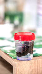 Close-up of medical jar with leeches in it , selective focus. Hirudotherapy procedure. Hirudotherapy, Ethnoscience and Alternative medicine. Bloodletting and rejuvenation treatment.