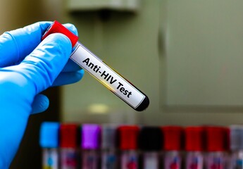 Blood sample tube for anti-HIV test analysis.