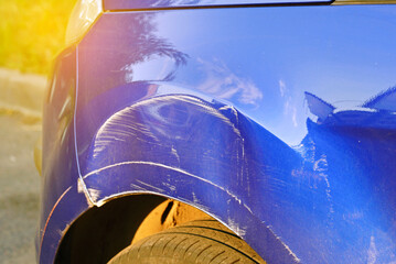 Damaged car front fender with large dent and visible scratches, impact and the need for repair. Scratched and dented car front fender with damage, worn car body exterior. Parking accident